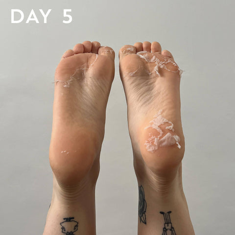 soin-exfoliant-professionnel-pour-les-pieds