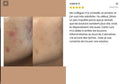 cure-detox-a-boire-anti-acne-peau-nette